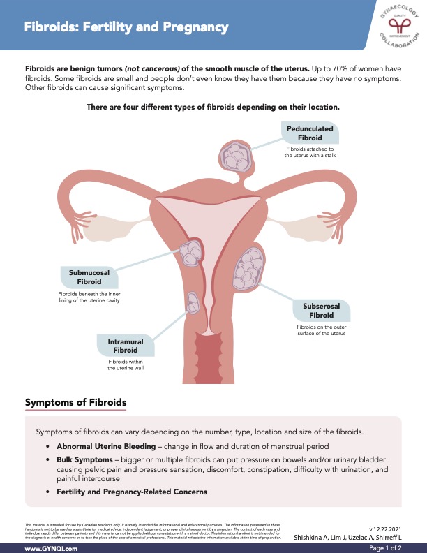 Fibroids Fertility and Pregnancy