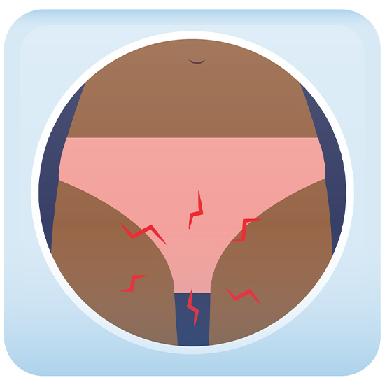 Genitourinary Syndrome of Menopause