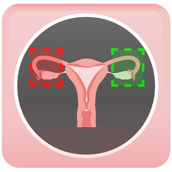 Ovarian Function After Hysterectomy