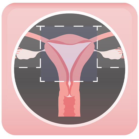 Types of Hysterectomy