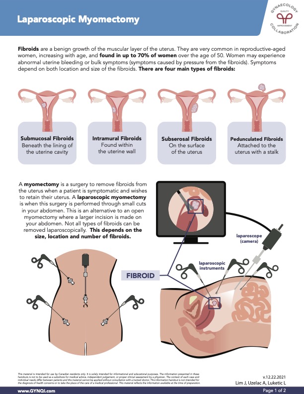 Laparoscopic Myomectomy