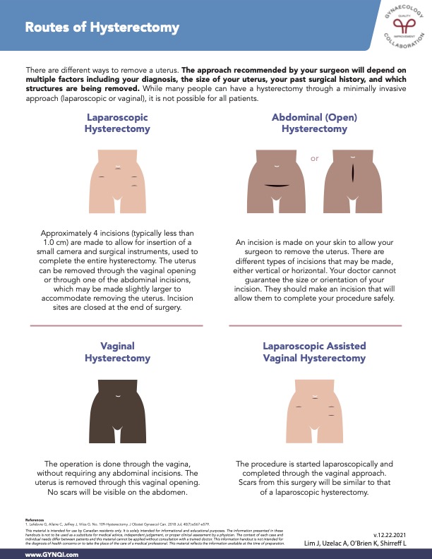 Routes of Hysterectomy