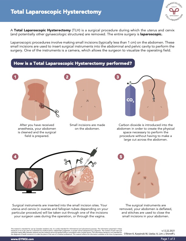 Total Laparoscopic Hysterectomy