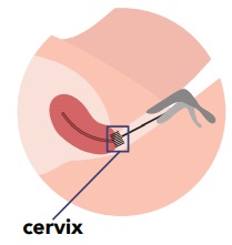 cervix