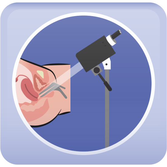 Colposcopy icon