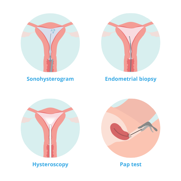 Illustrations of procedures used for diagnosing heavy periods including Sonohysterogram, Endometrial biopsy, Hysteroscopy and Pap test.